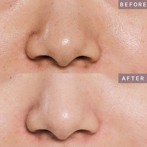 Pot Pore Peptamin Wash Off Pack