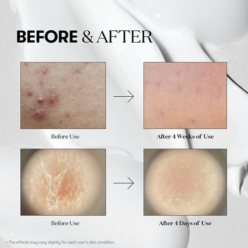 Reedle Shot 300 Stick Pouch