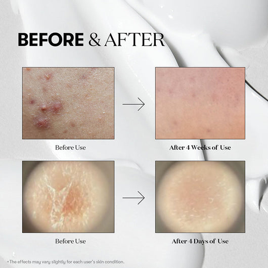 Reedle Shot 300 Stick Pouch