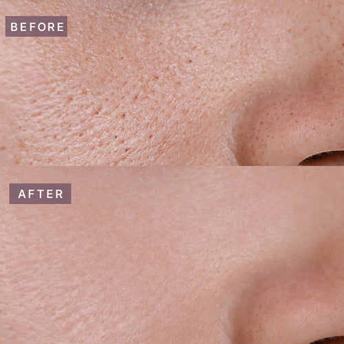 Pot Pore Tightening Podo Ampoule