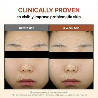 By Wishtrend - Mandelic Acid Gentle Exfoliating Toner