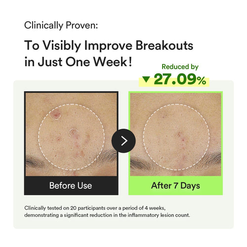 Abib - Heartleaf TECA capsule serum Calming drop