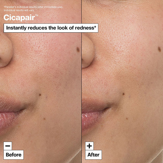 Cicapair™ Intensive Soothing Repair Cream