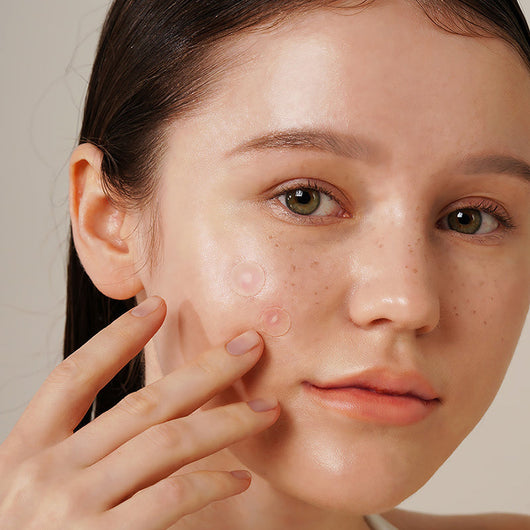 Onion Newpair Spot Patch Basic